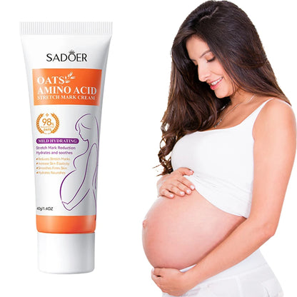 Removes Stretch Mark Cream to Remove Postpartum Obesity Pregnant Women Repair Anti-Aging Winkles Firming Body Cream Skin Care